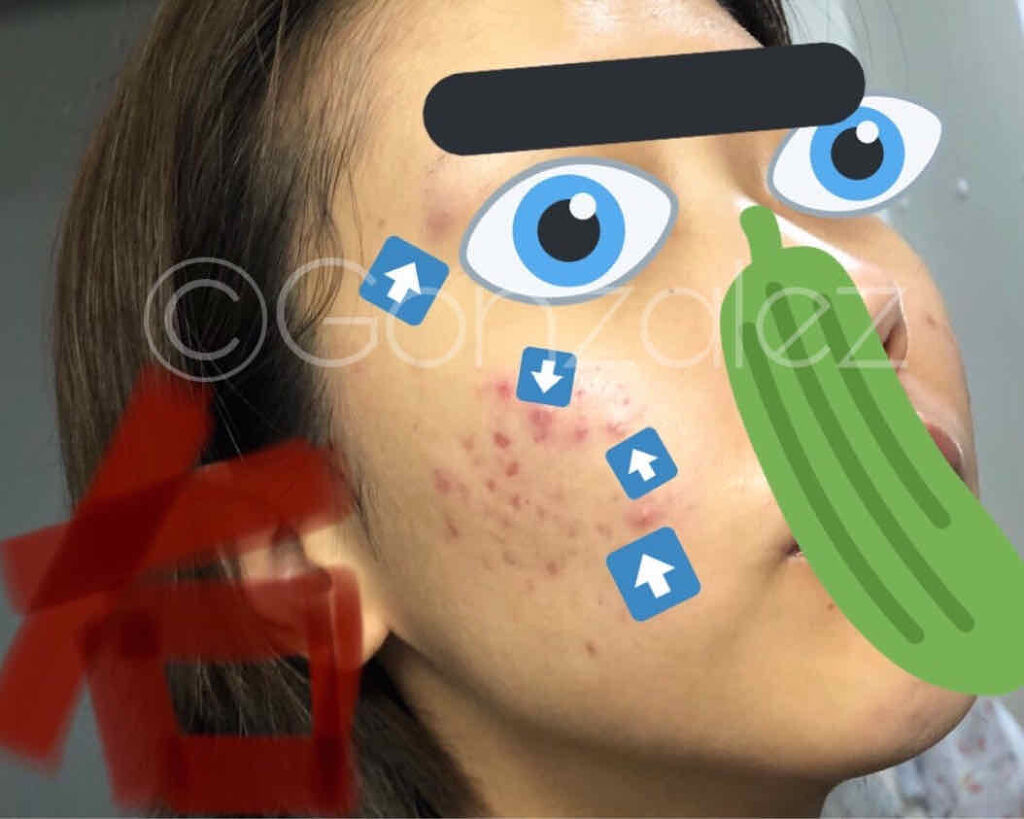 1025 独島 トナー/ROUND LAB/化粧水を使ったクチコミ（2枚目）