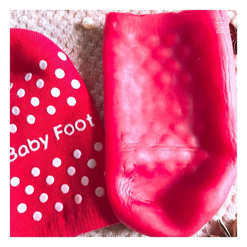 ベビーフット 保湿密封ソックス/ベビーフット/レッグ・フットケアを使ったクチコミ(3枚目)