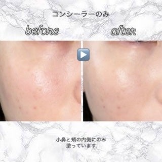 ダーマシンコンシーラー/23years old/リキッドコンシーラーを使ったクチコミ(4枚目)