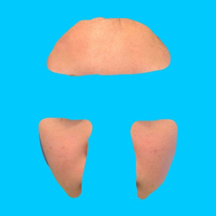 ビーソフテン ローション(医薬品)/持田製薬/その他を使ったクチコミ(2枚目)