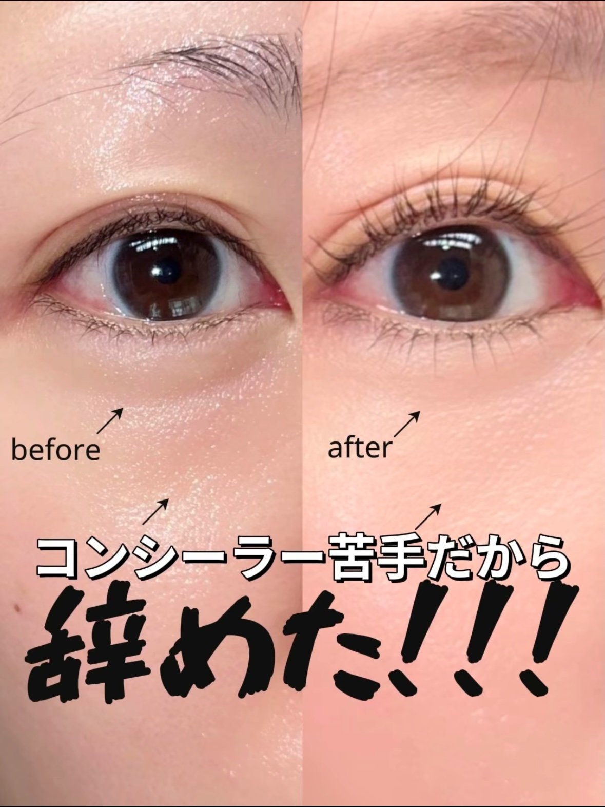 アイレノール クマクリーム/IRENOL/アイケア・アイクリームを使ったクチコミ（1枚目）