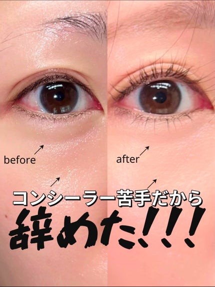 アイレノール クマクリーム/IRENOL/アイケア・アイクリームを使ったクチコミ(1枚目)