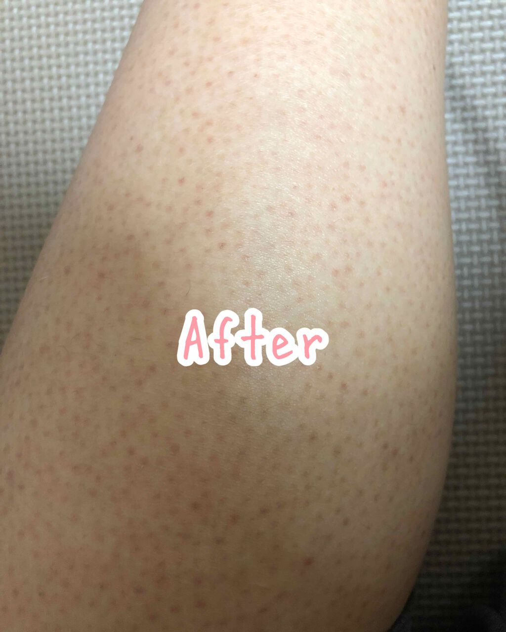 ハトムギ化粧水(ナチュリエ スキンコンディショナー R )/ナチュリエ/化粧水を使ったクチコミ（3枚目）