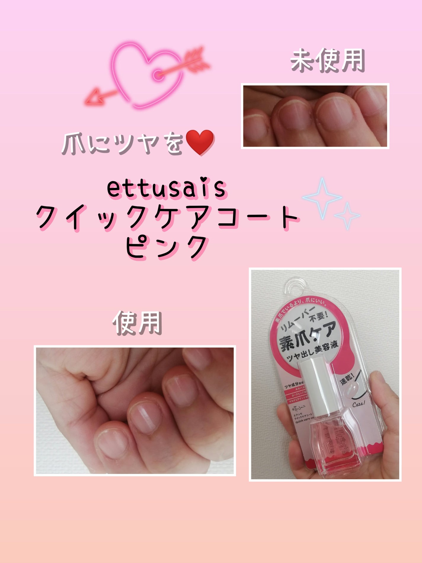 エテュセ クイックケアコート/ettusais/ネイルオイル・トリートメントを使ったクチコミ(1枚目)