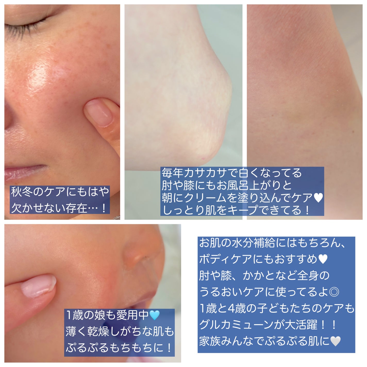 グルカミューンクリーム/VT/フェイスクリームを使ったクチコミ(2枚目)