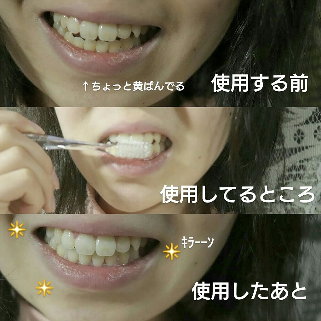 HITEETH ALL IN ONE MOUTH GEL/R&/歯磨き粉を使ったクチコミ（3枚目）