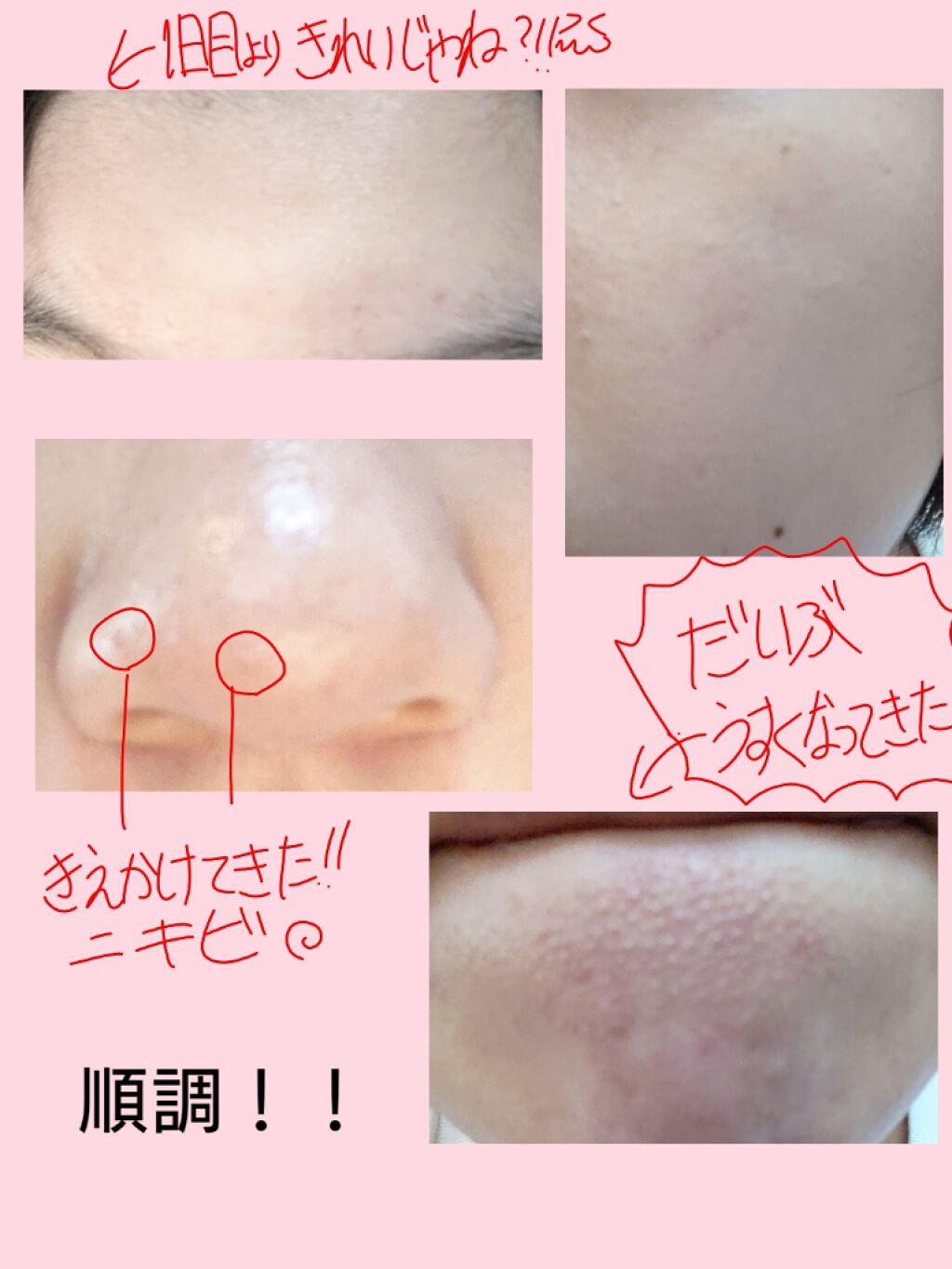 薬用洗顔フォーム/スキンライフ/洗顔フォームを使ったクチコミ(2枚目)