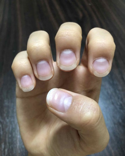 ネイルベッドオイル/アンドネイル/ネイルオイル・トリートメントを使ったクチコミ(2枚目)