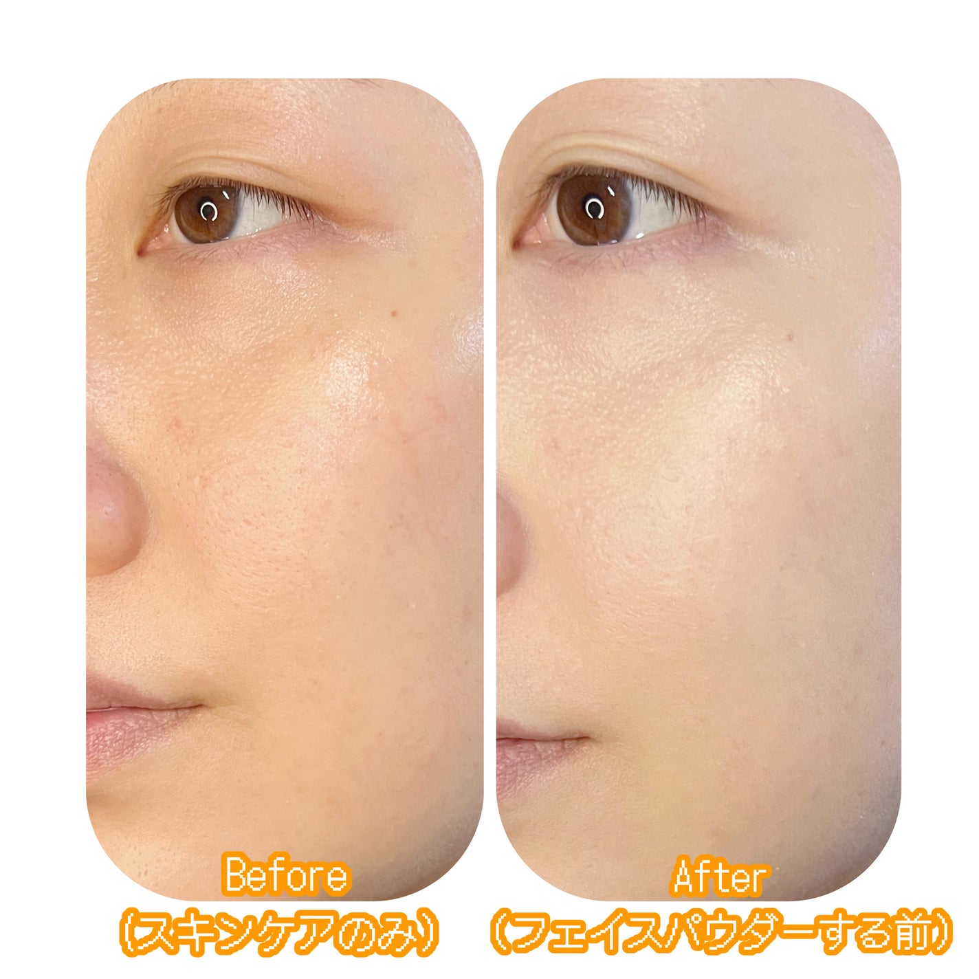 SIGNATURE ESSENCE COVER PACT /AGE20’s/クリーム・エマルジョンファンデーションを使ったクチコミ(6枚目)