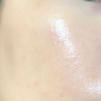 目ざまシート ビタットC/サボリーノ/シートマスク・パックを使ったクチコミ(5枚目)