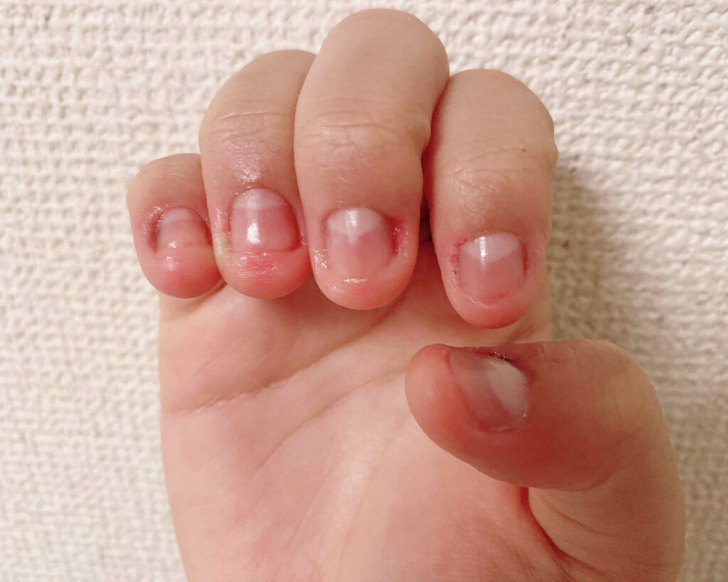 AC キューティクルオイル/AC MAKEUP/ネイルオイル・トリートメントを使ったクチコミ（3枚目）