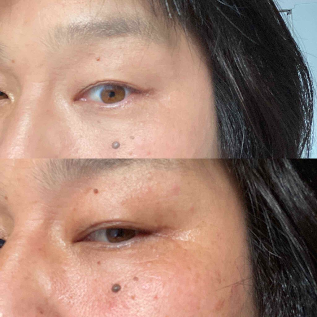 スキンカラーコントロール/ACSEINE/クリームコンシーラーを使ったクチコミ（2枚目）