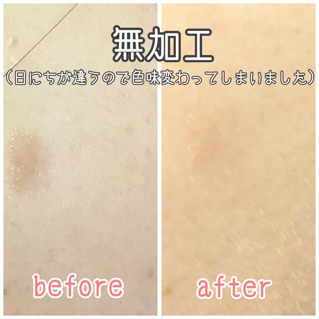 キララ❣️ 様　ホームケア　３点　ハイドロ追加 BDM-030対応】eXtremeRate ホールクリッキーキット組み立て（背面