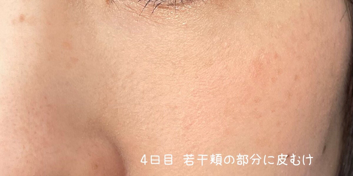 RXザ・レチノール0.1クリーム/COSRX/フェイスクリームを使ったクチコミ(2枚目)