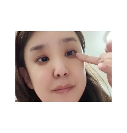 金のプラセンタもっちり白肌濃クマトリーナ/ホワイトラベル/アイケア・アイクリームを使ったクチコミ(3枚目)