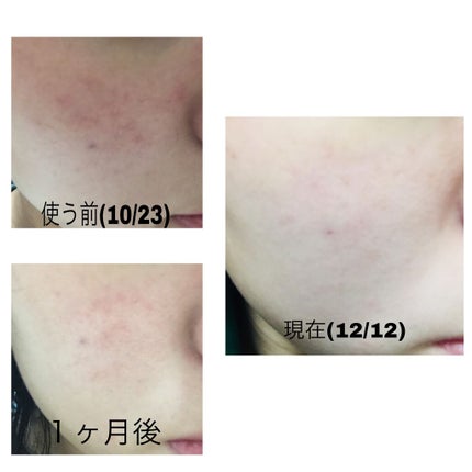 ハトムギ化粧水(ナチュリエ スキンコンディショナー R )/ナチュリエ/化粧水を使ったクチコミ(2枚目)