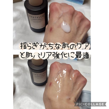 センテラ クイックカーミングパッド/SKIN1004/トナーパッドを使ったクチコミ(4枚目)