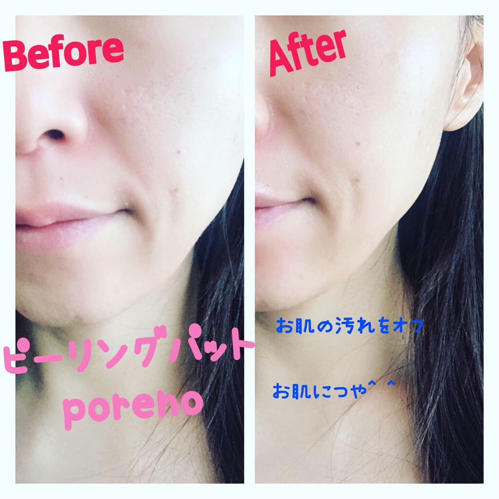 ピーリングパッド ポアノ/ウツクシア/トナーパッドを使ったクチコミ（2枚目）