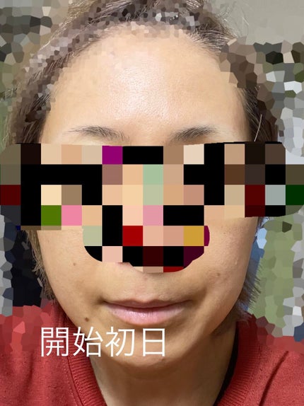 南禅寺きなこ on LIPS 「レチノールの使いはじめて2か月弱…初日は極小量と乳液を混ぜて使..」(2枚目)