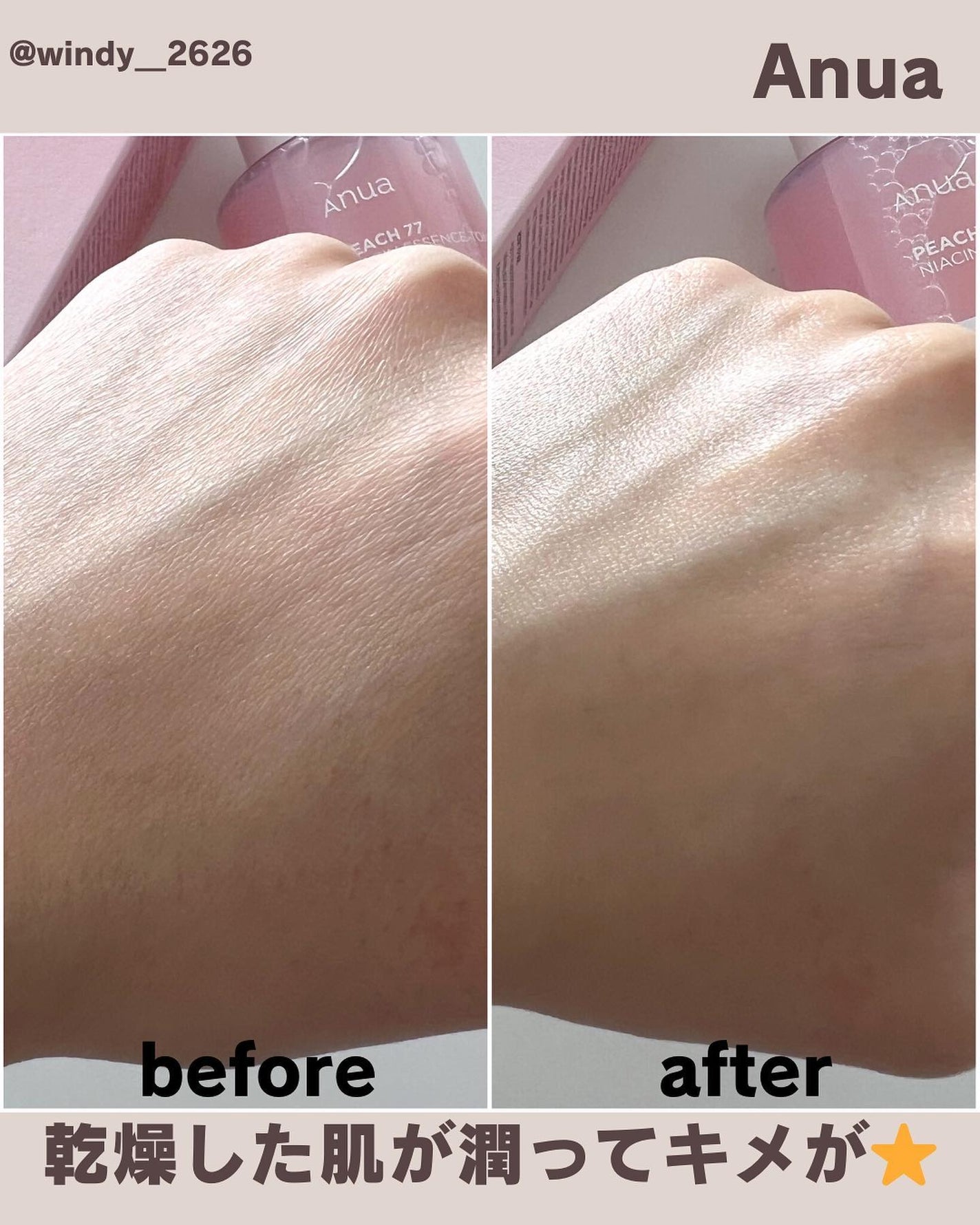 桃77%ナイアシンエッセンストナー 250ml/Anua/化粧水を使ったクチコミ(4枚目)
