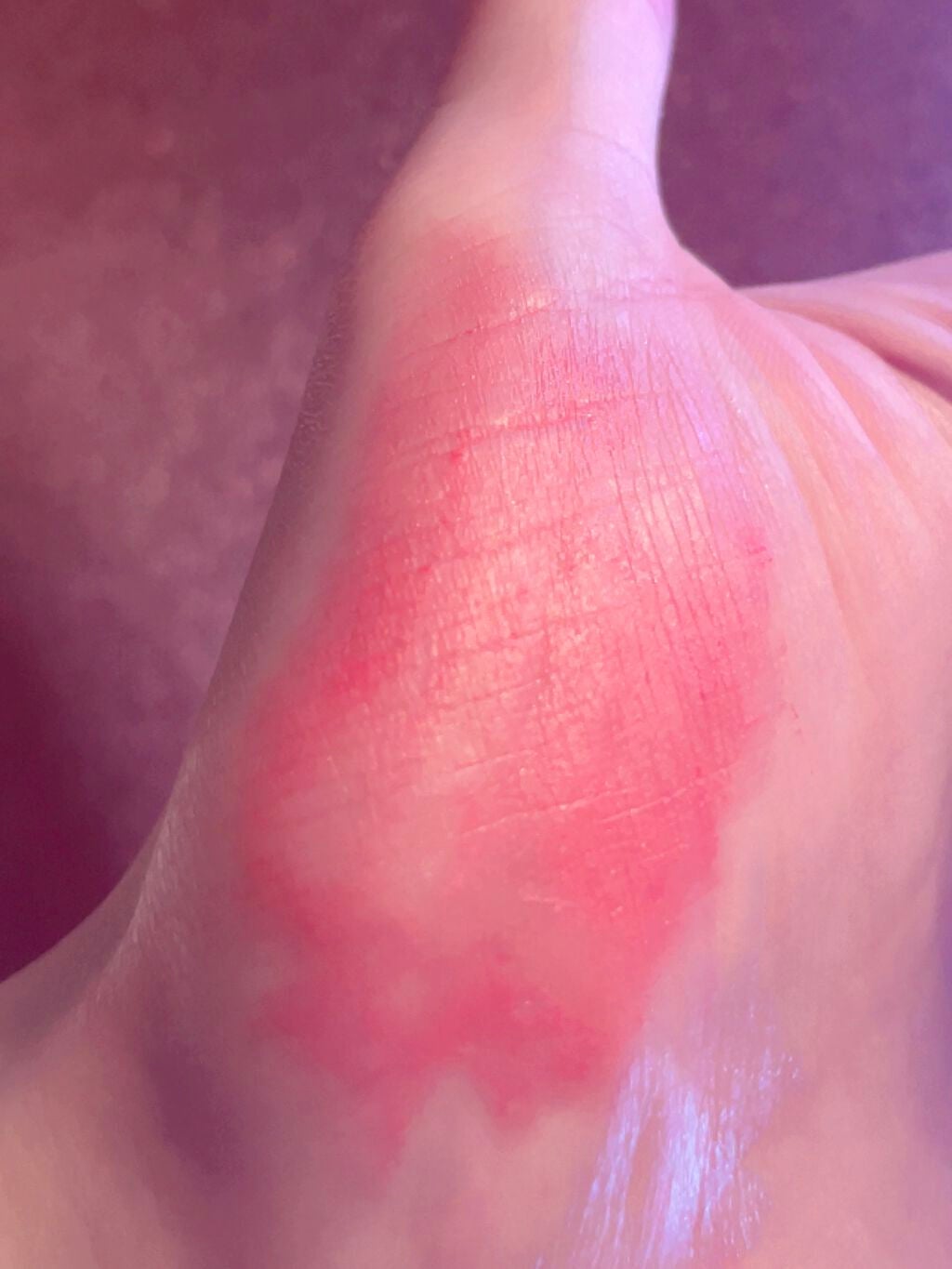 マルチグロウスティック/WHOMEE/ジェル・クリームチークを使ったクチコミ(6枚目)