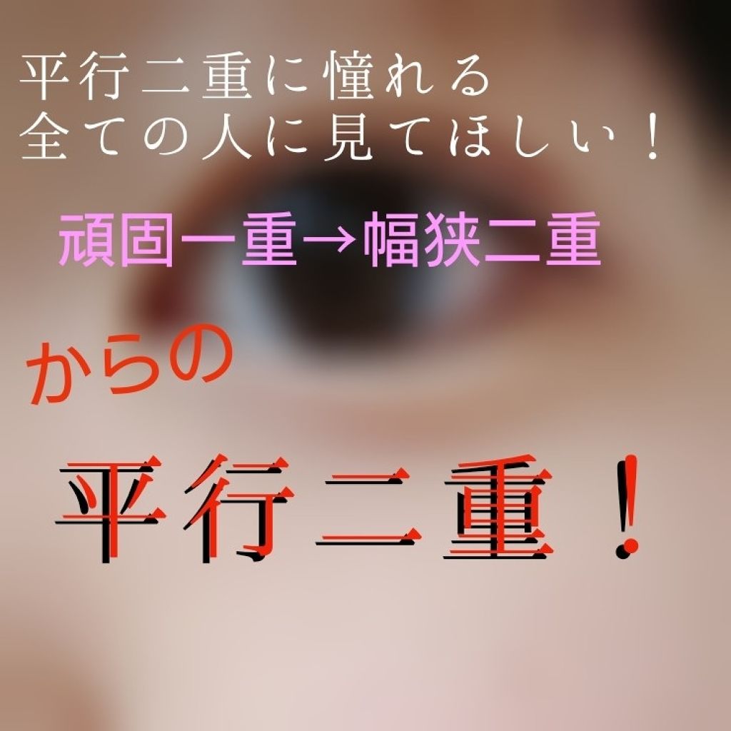 ゆっちゃ on LIPS 「◤◢◤◢注意◤◢◤◢目の画像沢山あります。苦手な方は🔙っで!!..」(1枚目)