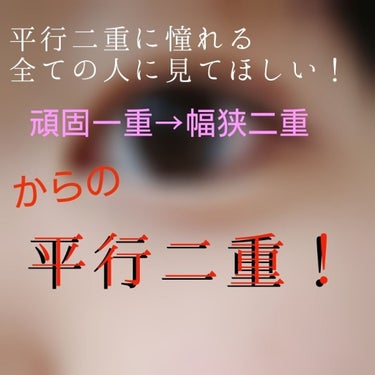 ゆっちゃ on LIPS 「◤◢◤◢注意◤◢◤◢目の画像沢山あります。苦手な方は🔙っで！！..」（1枚目）