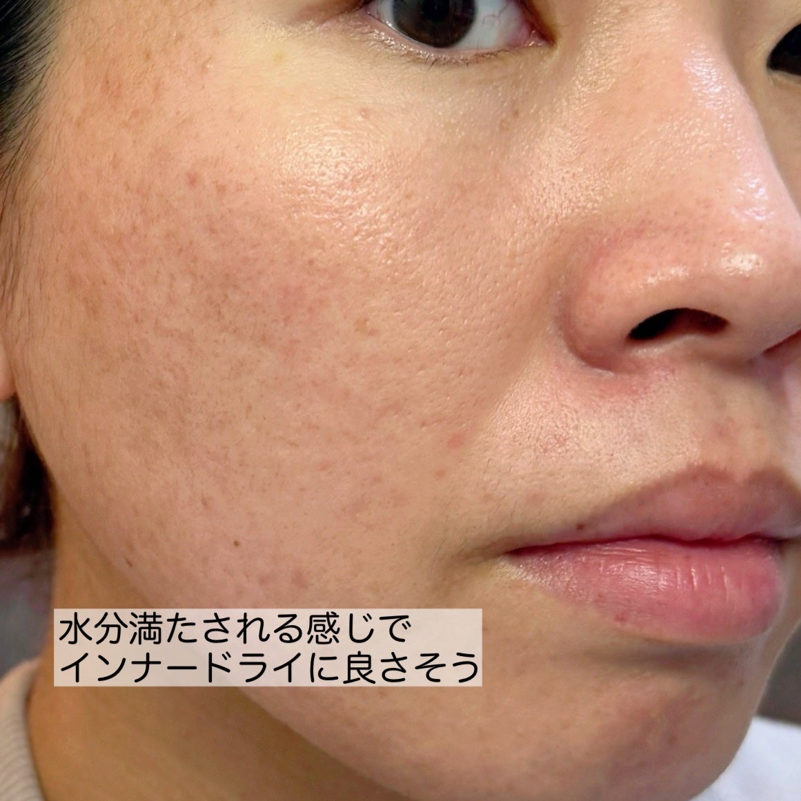 リペア薬用保湿化粧水 しっとり/コラージュ/化粧水を使ったクチコミ(3枚目)