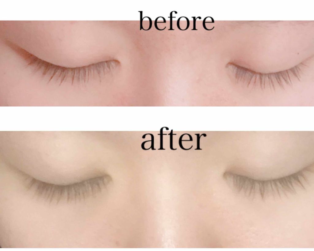 ローヤルゼリー配合 栄養ローション/DAISO/美容液を使ったクチコミ(2枚目)