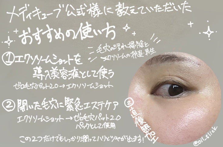 ゼロ毛穴パッド 2.0/MEDICUBE/トナーパッドを使ったクチコミ(5枚目)