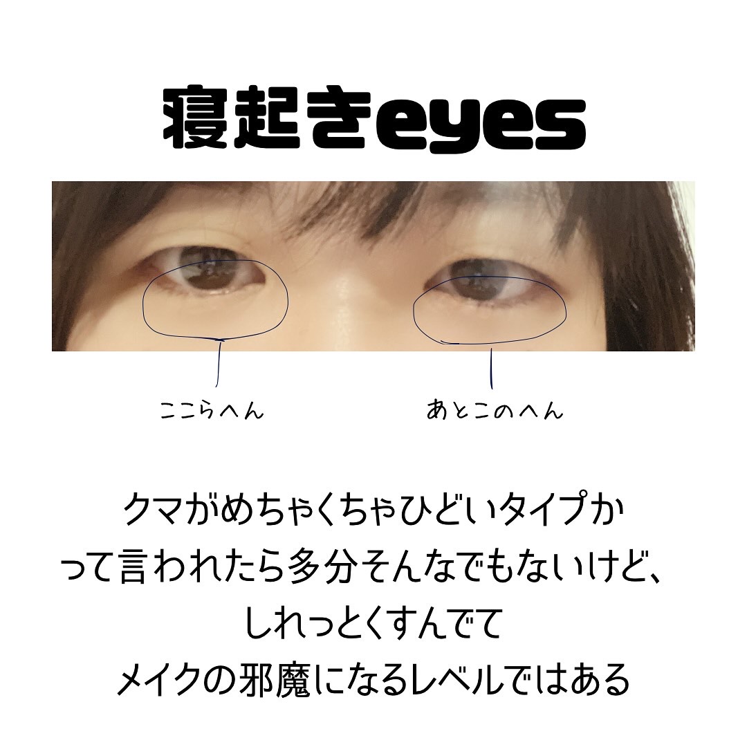 アイレノール クマクリーム/IRENOL/アイケア・アイクリームを使ったクチコミ（2枚目）