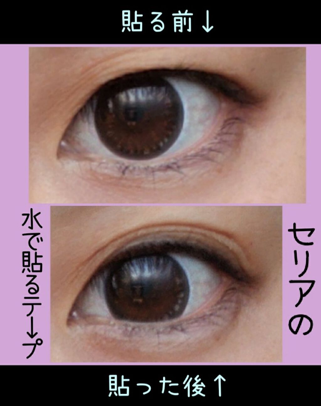 のびーるアイテープ（絆創膏タイプ、レギュラー）/DAISO/二重まぶた用アイテムを使ったクチコミ（2枚目）