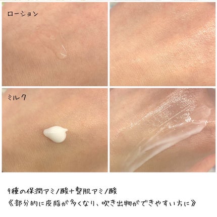 ミノン アミノモイスト 薬用アクネケア ローション/ミノン/化粧水を使ったクチコミ(4枚目)