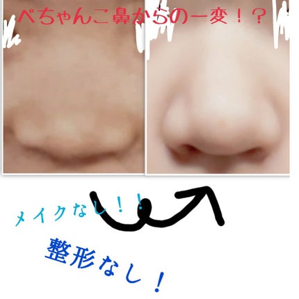 あいうえお on LIPS 「こんばんわ!\あいうえおです。/今回はぺちゃんこ鼻からの大変身..」(1枚目)