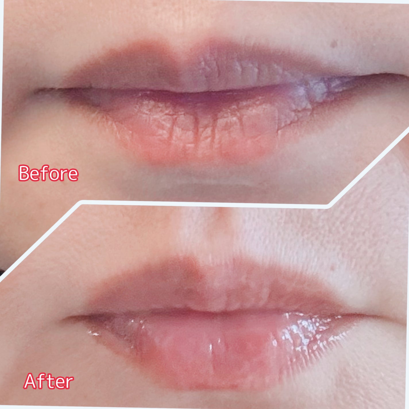 エテルナムリップセラム /エテルナム/リップ美容液を使ったクチコミ(5枚目)