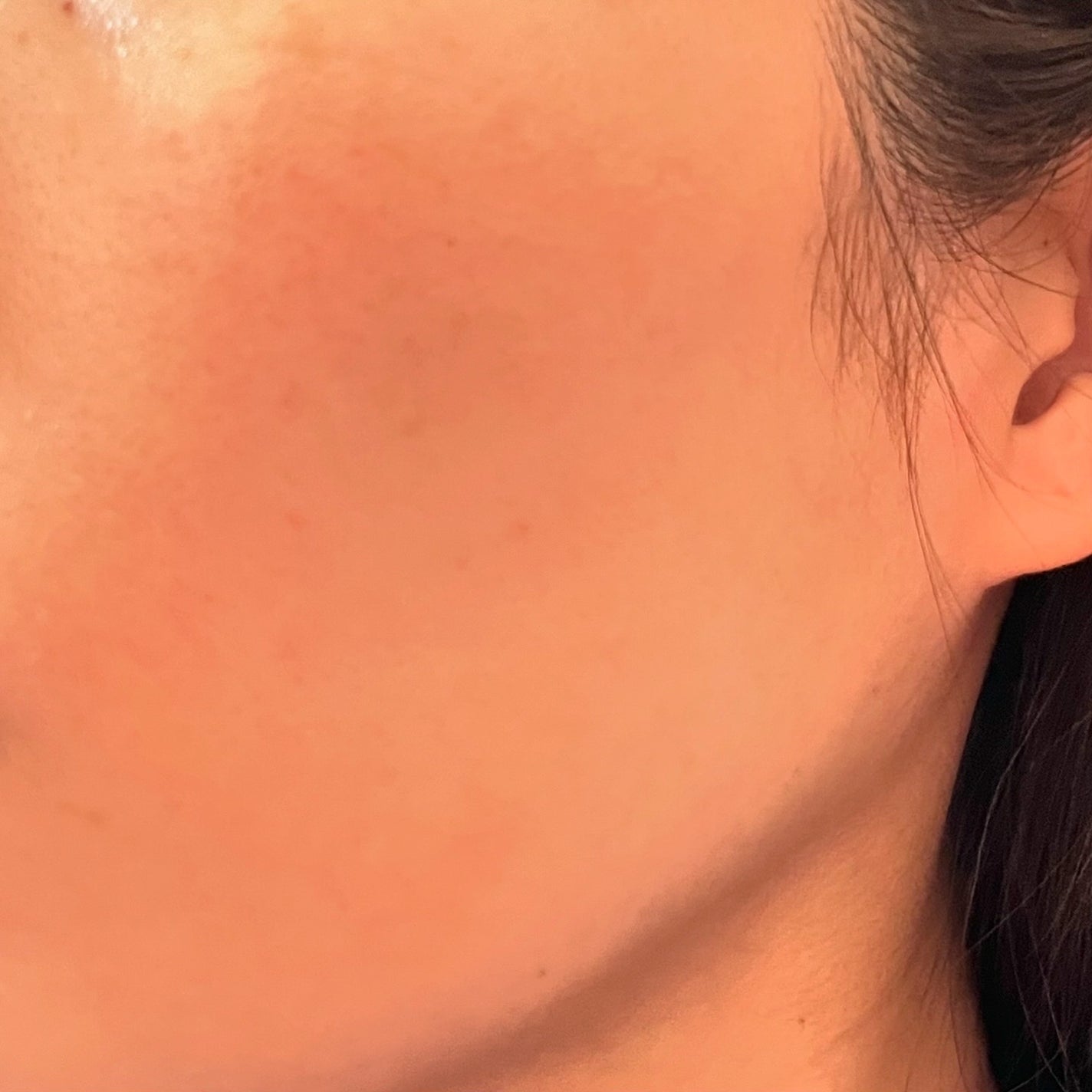 シカルファットプラス リペアミルク/アベンヌ/乳液を使ったクチコミ(3枚目)