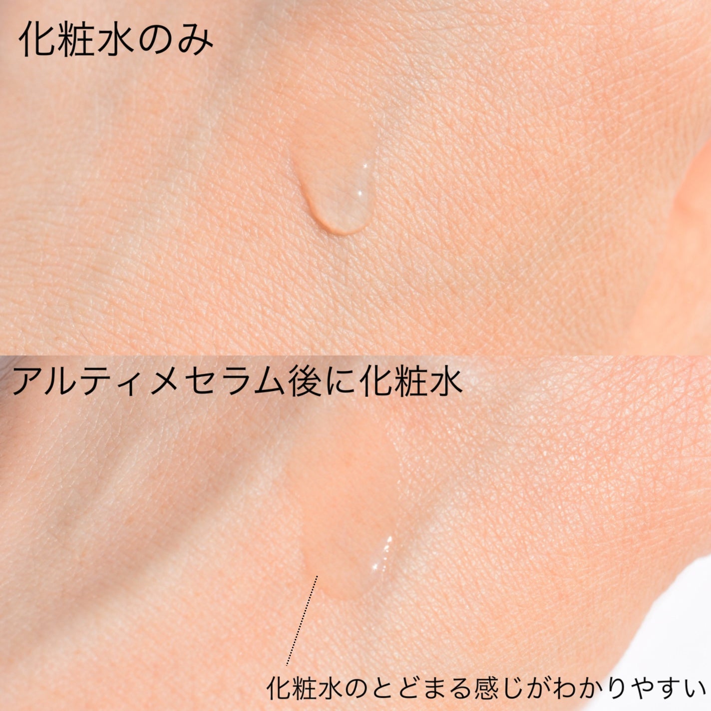 ジェニフィック アルティメ セラム/LANCOME/美容液を使ったクチコミ(4枚目)