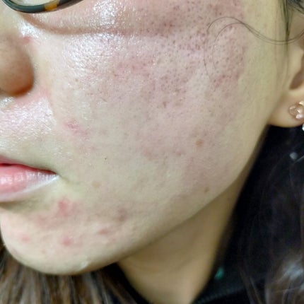 サンホワイトP-1/サンホワイト/ボディクリームを使ったクチコミ(6枚目)