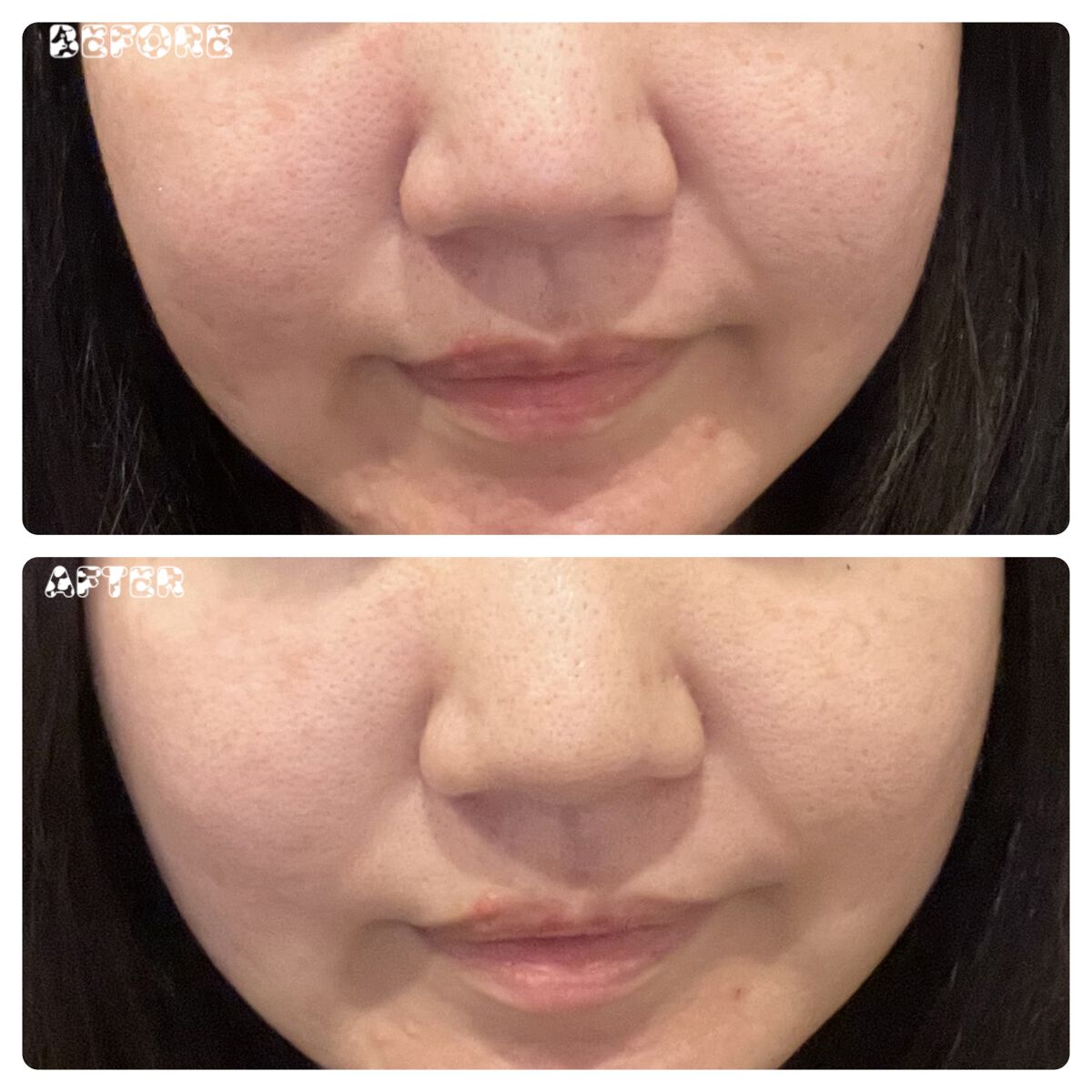 アカルミー化粧水/ワイズ/化粧水を使ったクチコミ（3枚目）