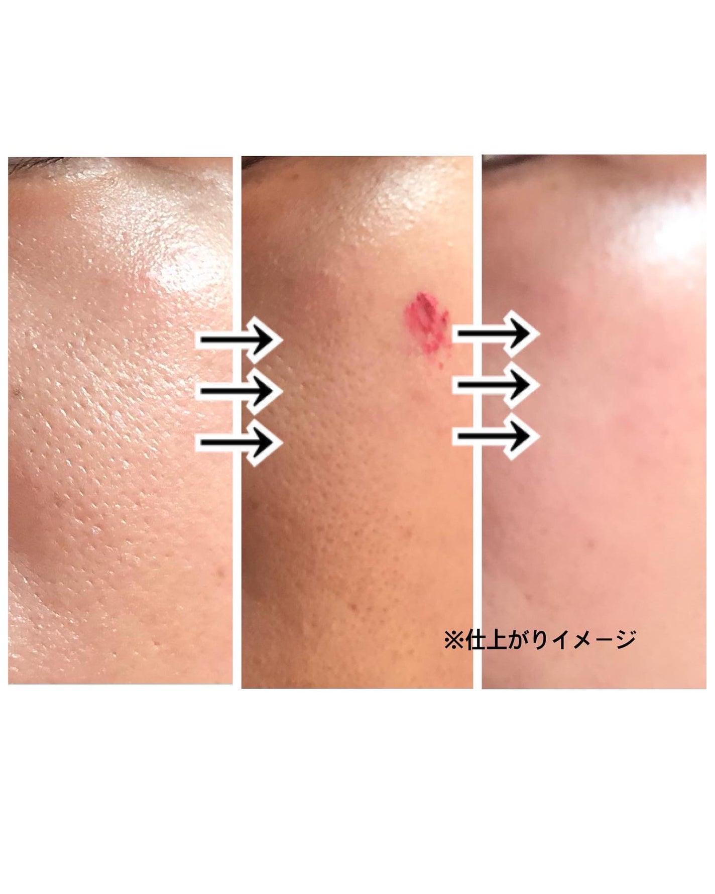 リップアンドチーク ブラーリープリンポット/fwee/口紅を使ったクチコミ(9枚目)