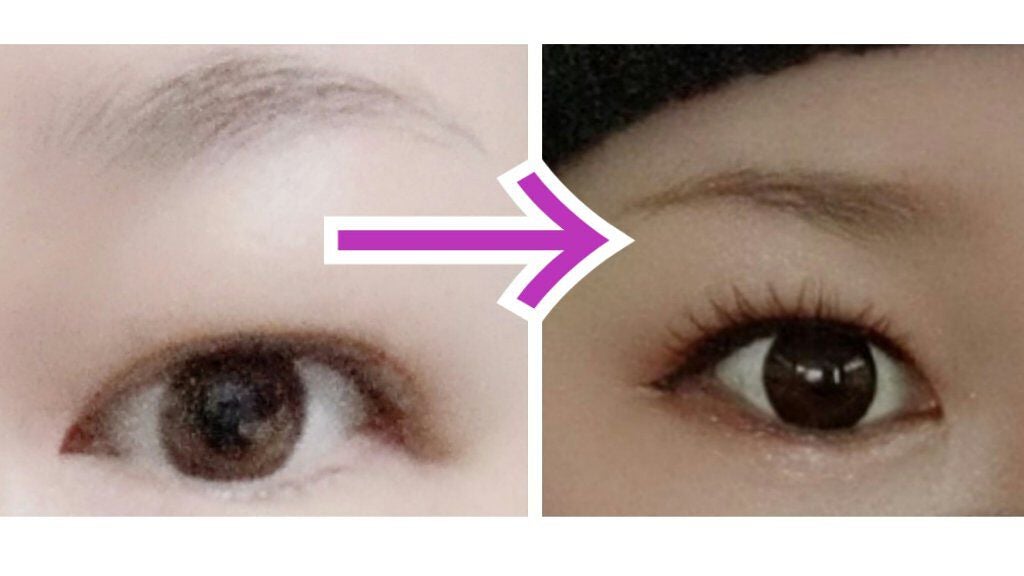 ふたえテープ 目立たず肌になじむ絆創膏タイプ/DAISO/二重まぶた用アイテムを使ったクチコミ(1枚目)