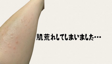 マイルド&モイスチャーアロエジェル/ネイチャーリパブリック/ボディローションを使ったクチコミ(2枚目)