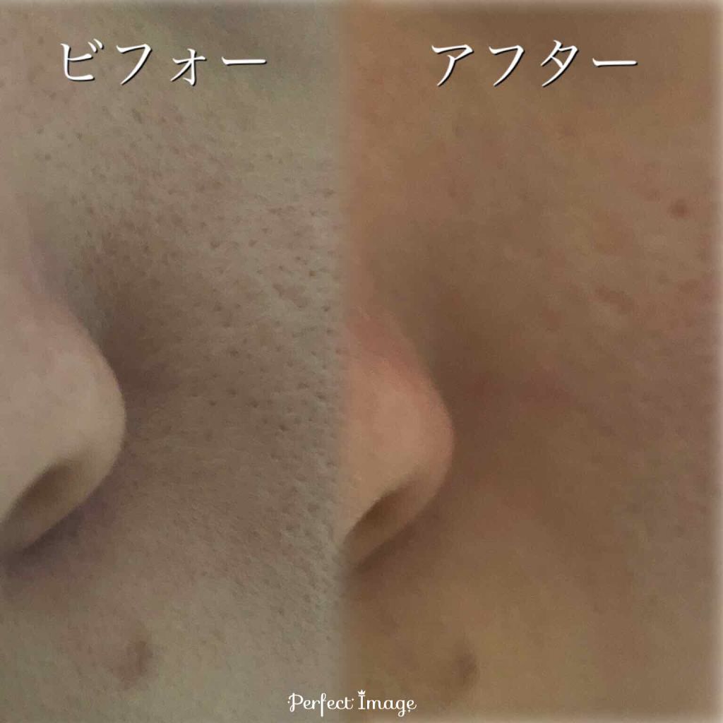 シラクル ビューティシート/Ciracle/トナーパッドを使ったクチコミ（3枚目）