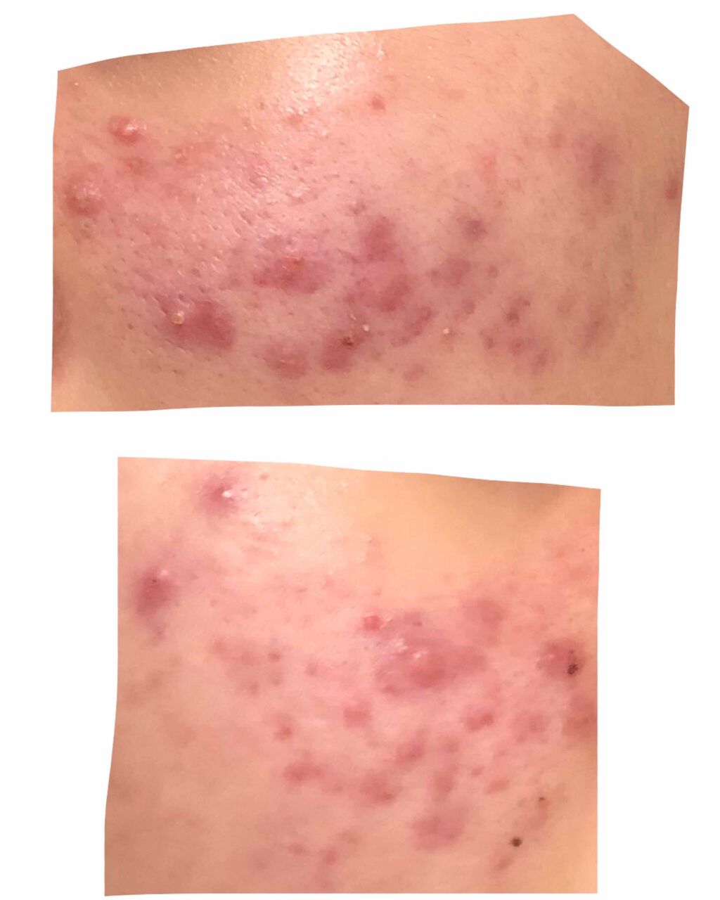 ハトムギ化粧水(ナチュリエ スキンコンディショナー R )/ナチュリエ/化粧水を使ったクチコミ(3枚目)