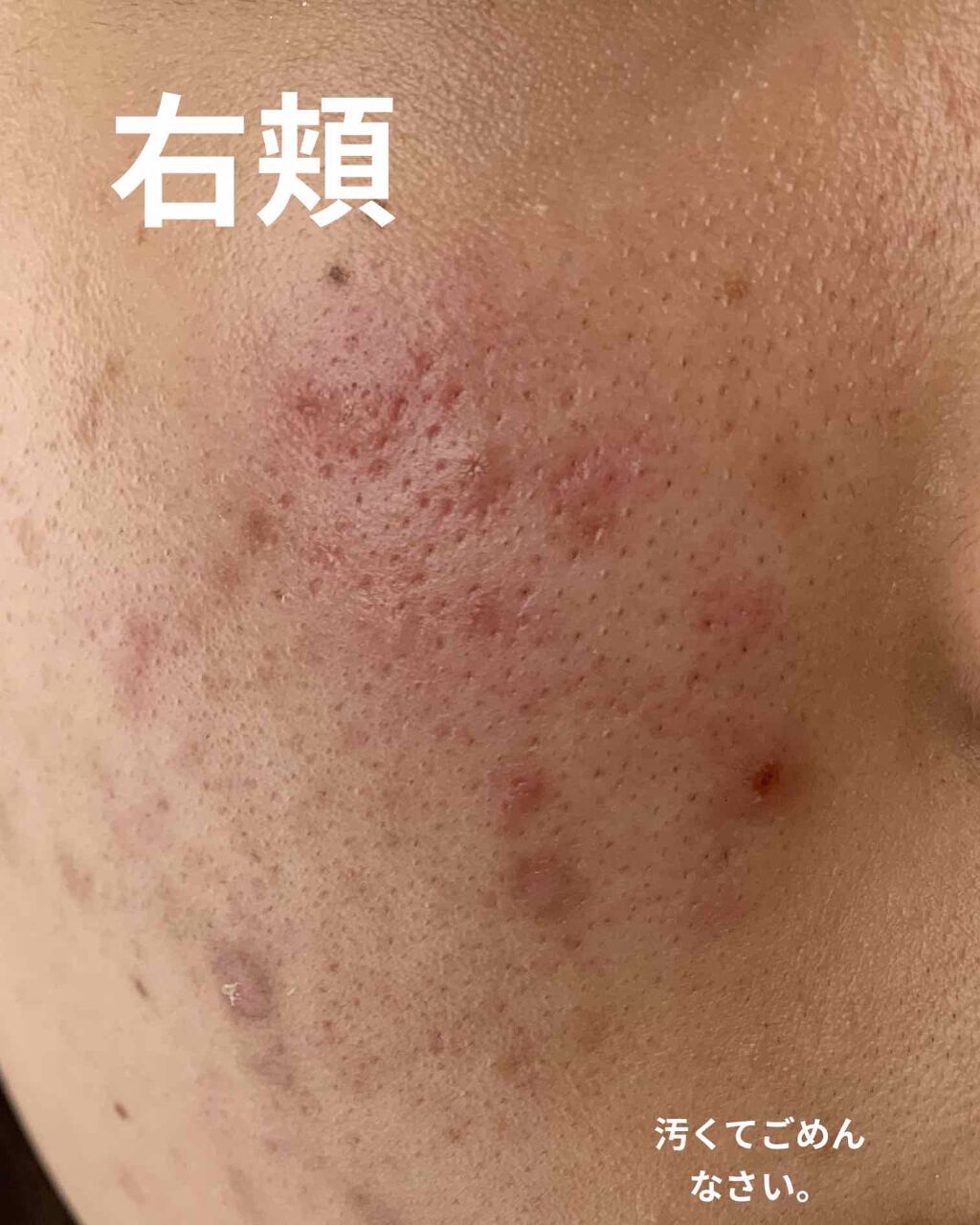 乳液・敏感肌用・しっとりタイプ/無印良品/乳液を使ったクチコミ(2枚目)