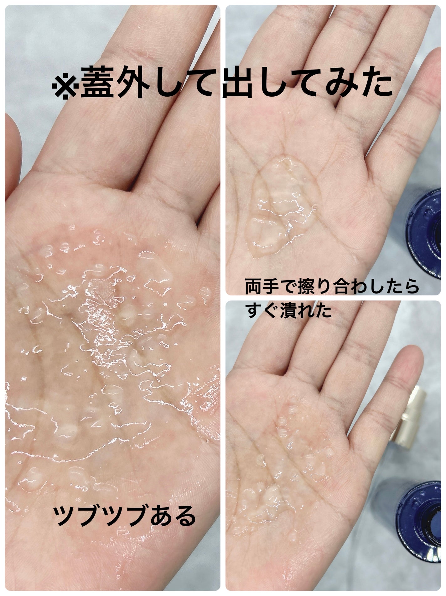 ブラックスネイル クリーム/Dr.G/フェイスクリームを使ったクチコミ(5枚目)