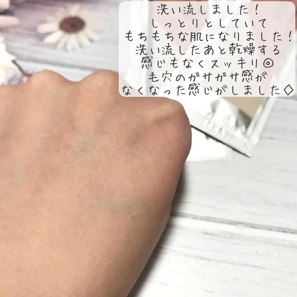 バブリングジェル/roseach/その他スキンケアを使ったクチコミ(6枚目)