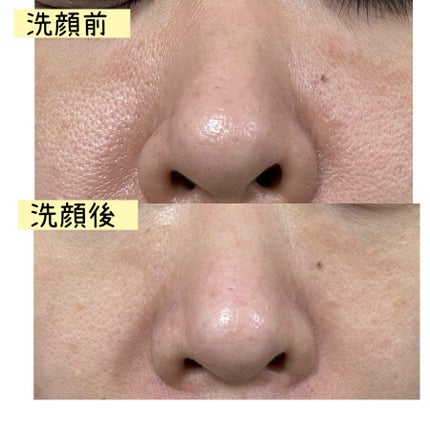 ディズム クリーミーフォームウォッシュ ブラック/DISM/泡洗顔を使ったクチコミ(4枚目)