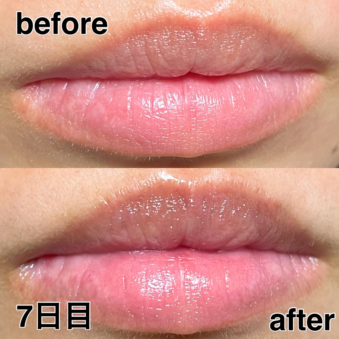 ゆーちゃか on LIPS 「どうにかしたい乾燥唇🫦プルプル唇パックでケアしてみた!・・・・..」(8枚目)