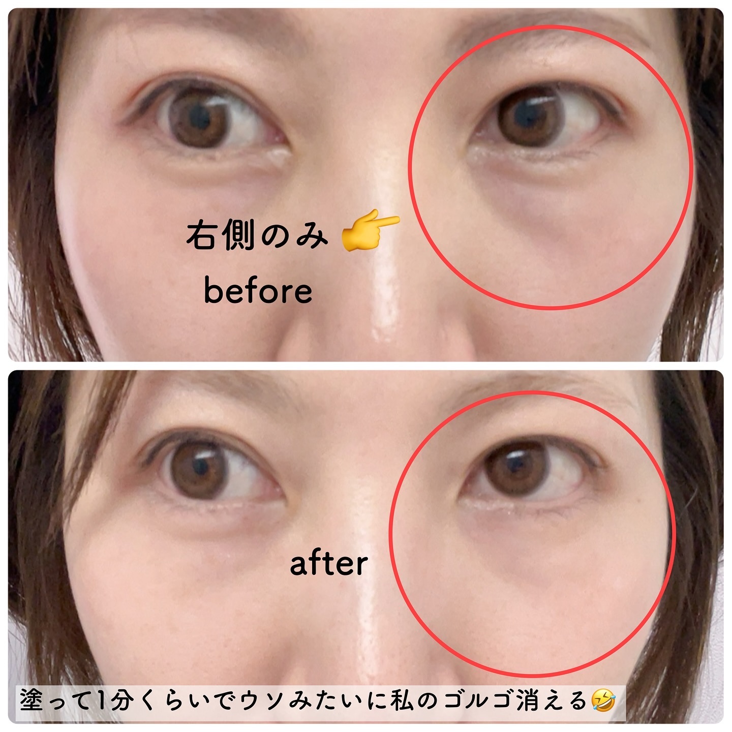 ドクターメラクチン.アイファルト アイバッククリーム Dr.Melaxin 正規取扱店 ⁄ 国内発送 アイファルト アイ